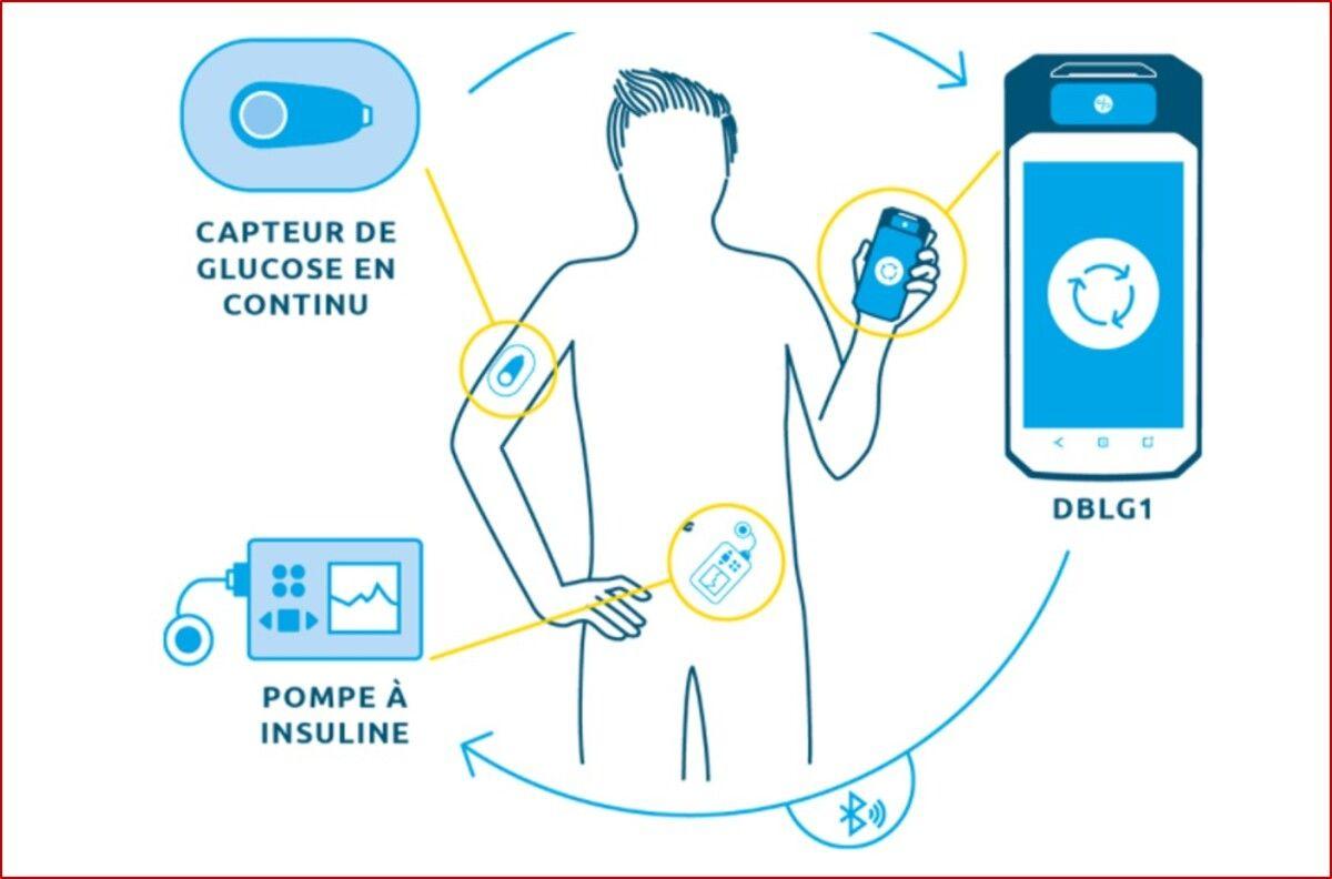 Diabète : Diabeloop, spécialiste de l'IA thérapeutique, lève 15 M€